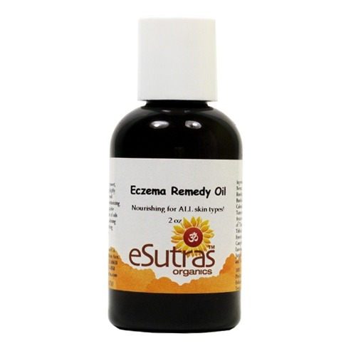 Ezcema Remedy